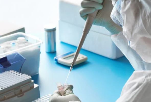 koronavirus pcr testy na slovensku odhalili takmer 1 500 pozitivnych ochoreniu podlahlo dalsich 23 pacientov