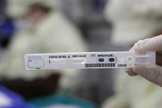 Niektoré nemocnice ponúkajú aj testovanie na protilátky proti Covid-19. Stačí pár kvapiek krvi