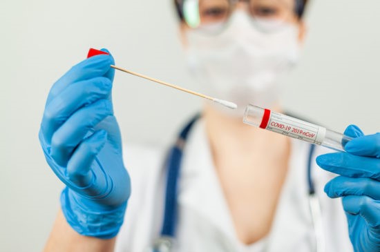 Koronavírus: Na Slovensku pribudlo 509 prípadov nákazy pri vyše osemtisíc PCR testoch
