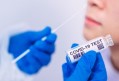 koronavirus na slovensku pribudlo 619 infikovanych aj jedno umrtie