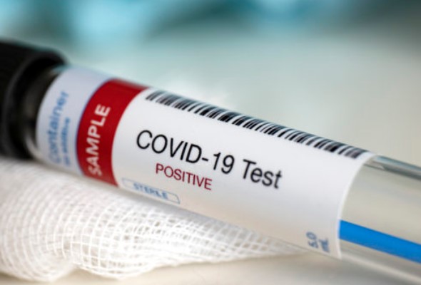 koronavirus na slovensku pcr testy potvrdili stovky pozitivnych v nemocniciach je 161 ludi