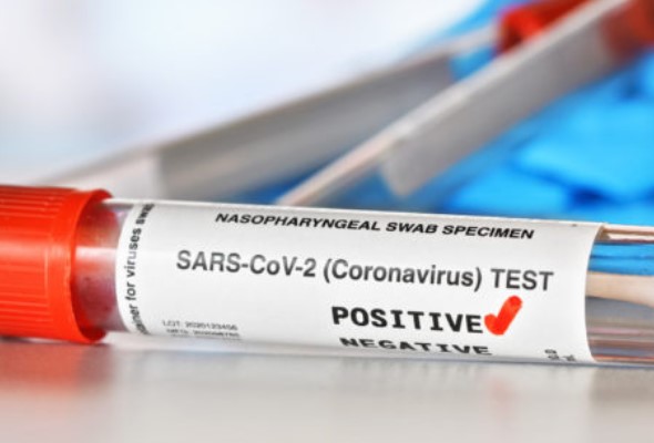 koronavirus testy odhalili na slovensku 550 pozitivnych ludi pribudli aj dve umrtia