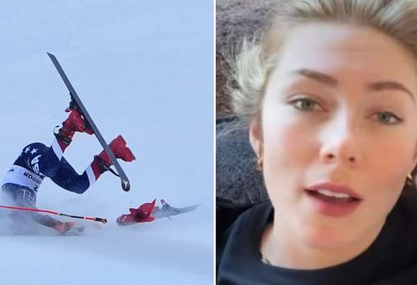 Krvácanie a veľká bolesť, Shiffrinová z gauča prezradila detaily o svojom stave VIDEO 